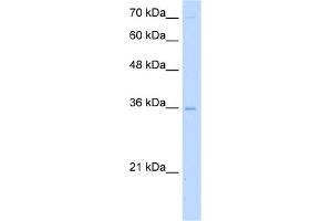WB Suggested Anti-PRIM2 Antibody Titration:  5. (PRIM2 anticorps  (Middle Region))