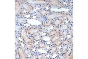 Immunohistochemistry of paraffin-embedded rat kidney using XPD/ERCC2 Rabbit mAb (ABIN7267057) at dilution of 1:100 (40x lens).
