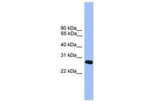 Image no. 1 for anti-Chromosome 1 Open Reading Frame 216 (C1ORF216) (AA 51-100) antibody (ABIN6746103) (C1ORF216 anticorps  (AA 51-100))