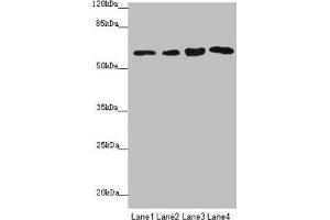 Western blot All lanes: FBXO7 antibody at 3. (FBXO7 anticorps  (AA 353-522))