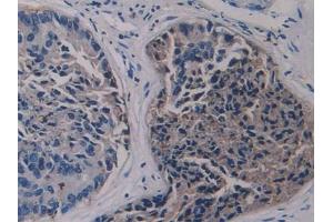 Used in DAB staining on fromalin fixed paraffin- embedded kidney tissue (LSR anticorps  (AA 335-589))