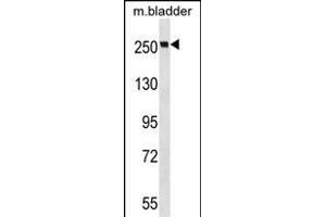 MYH9 Antibody (N-term ) (ABIN6243267 and ABIN6577348) western blot analysis in mouse bladder tissue lysates (35 μg/lane). (Myosin 9 anticorps  (N-Term))