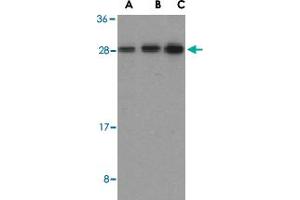 Western blot analysis of BID in mouse lung tissue lysates with BID polyclonal antibody  at (A) 0. (BID anticorps  (C-Term))