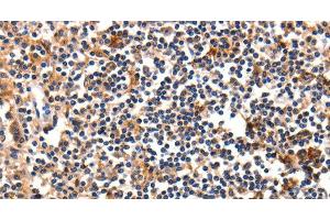 Immunohistochemistry of paraffin-embedded Human tonsil using FADD Polyclonal Antibody at dilution of 1:35 (FADD anticorps)