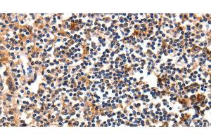 Immunohistochemistry of paraffin-embedded Human tonsil using FADD Polyclonal Antibody at dilution of 1:35