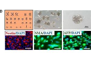 Characteristics of iPSCs derived from RP patient urine cells.