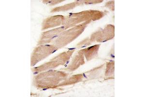 Formalin-fixed and paraffin-embedded human skeletal muscle reacted with PRK antibody (C-term) (ABIN391608 and ABIN2841530) , which was peroxidase-conjugated to the secondary antibody, followed by DAB staining.