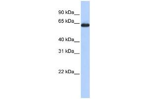 Western Blotting (WB) image for anti-Solute Carrier Family 34 (Sodium Phosphate), Member 3 (SLC34A3) antibody (ABIN2457906) (SLC34A3 anticorps)