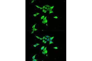 Immunofluorescence analysis of A549 cell using CD55 antibody. (CD55 anticorps)