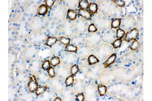 Anti- CYP1B1 Picoband antibody,IHC(P) IHC(P): Mouse Kidney Tissue
