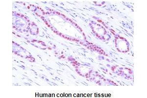 Immunohistochemistry (IHC) image for anti-Methionine Adenosyltransferase II, alpha (MAT2A) (AA 1-395), (N-Term) antibody (ABIN356234) (MAT2A anticorps  (N-Term))
