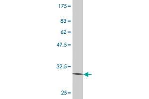 Western Blot detection against Immunogen (31. (Vasn anticorps  (AA 298-349))