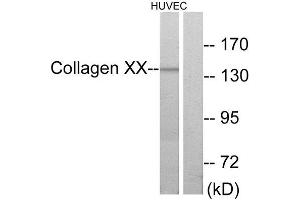 Western Blotting (WB) image for anti-Collagen, Type X, alpha 1 (COL10A1) (C-Term) antibody (ABIN1850314) (COL10A1 anticorps  (C-Term))