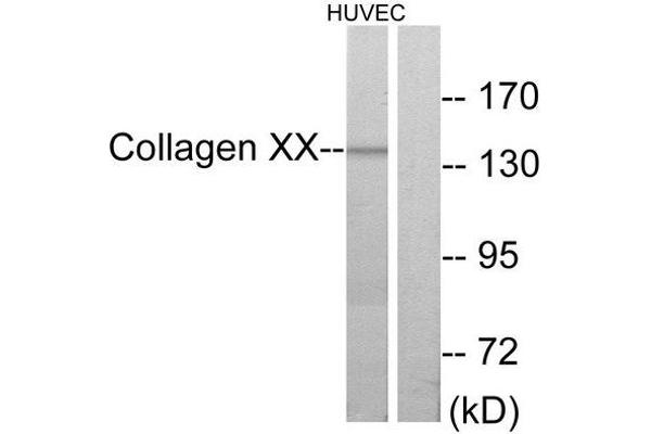 COL10A1 antibody  (C-Term)