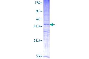 SDS-PAGE (SDS) image for Mal, T Cell Differentiation Protein 2 (MAL2) (AA 1-176) protein (GST tag) (ABIN1310109)