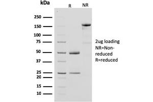 SDS-PAGE Analysis Purified CKBB Mouse Monoclonal Antibody (CPTC-CKB-2). (CKB anticorps)