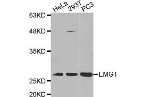 Western Blotting (WB) image for anti-EMG1 Nucleolar Protein Homolog (EMG1) antibody (ABIN1875902) (EMG1 anticorps)