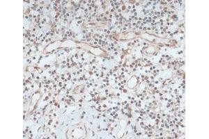 Immunohistochemistry of paraffin-embedded Human tonsil using ZNF416 Polyclonal Antibody at dilution of 1:100 (40x lens). (ZNF416 anticorps)