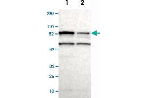 Western Blot analysis of Lane 1: RT-4 and Lane 2: U-251MG sp cell lysates with RPS6KA6 polyclonal antibody . (RPS6KA6 anticorps)
