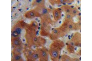 IHC-P analysis of Liver tissue, with DAB staining. (IL1RN anticorps  (AA 27-178))