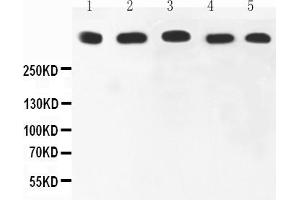 Anti-Ki67 Picoband antibody, All lanes: Anti-Ki67 at 0. (Ki-67 anticorps  (AA 2860-3256))