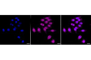 Immunocytochemical staining of HepG2 cells with ALKBH1 antibody (ABIN7797579), 1:1,000).