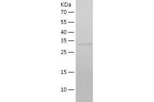 Western Blotting (WB) image for Cathepsin L1 (CTSL1) (AA 18-333) protein (His-IF2DI Tag) (ABIN7122182)