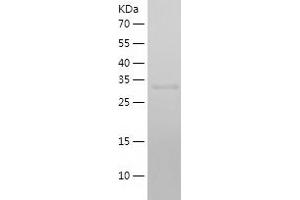 Cathepsin L Protein (AA 18-333) (His tag)