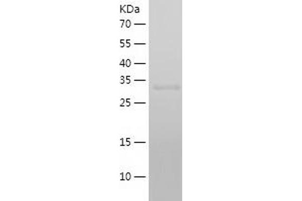 Cathepsin L Protein (AA 18-333) (His tag)