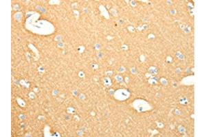 The image on the left is immunohistochemistry of paraffin-embedded Human brain tissue using ABIN7131115(SNAP25 Antibody) at dilution 1/25, on the right is treated with fusion protein.