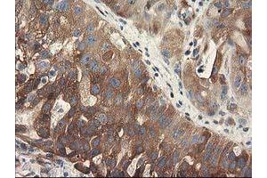 Image no. 1 for anti-Breast Cancer Anti-Estrogen Resistance 1 (BCAR1) antibody (ABIN1496834)