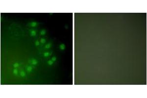 Immunofluorescence analysis of A549 cells, using p63 Antibody. (TCP1 alpha/CCTA anticorps  (AA 631-680))