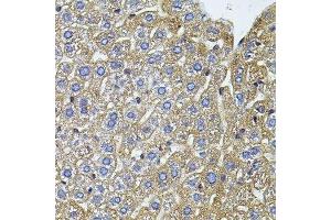 Immunohistochemistry of paraffin-embedded mouse liver using CETP antibody. (CETP anticorps  (AA 300-493))
