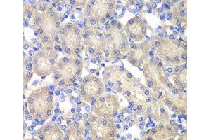 Immunohistochemistry of paraffin-embedded Rat kidney using ACY1 Polyclonal Antibody at dilution of 1:100 (40x lens). (Aminoacylase 1 anticorps)