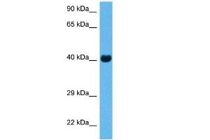 Host:  Rabbit  Target Name:  CKM  Sample Tissue:  Mouse Skeletal Muscle  Antibody Dilution:  1ug/ml (CKM anticorps  (N-Term))