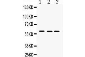 Western Blotting (WB) image for anti-Flavin Containing Monooxygenase 3 (FMO3) (AA 404-433), (C-Term) antibody (ABIN3043830) (FMO3 anticorps  (C-Term))