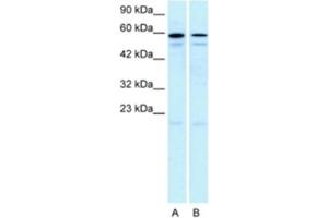 Western Blotting (WB) image for anti-5-Hydroxytryptamine (serotonin) Receptor 2C (HTR2C) antibody (ABIN2463752) (HTR2C anticorps)