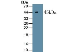 Detection of Recombinant MyoD, Human using Polyclonal Antibody to Myogenic Differentiation (MyoD)