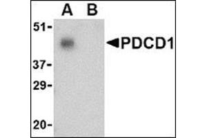 Western blot analysis of PD-1 in THP-1 cell lysate with AP30650PU-N PD1 antibody at 1 μg/ml in the (A) absence and (B) presence of blocking peptide. (PD-1 anticorps  (C-Term))