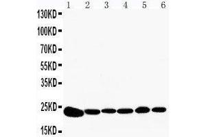 Anti-Peroxiredoxin 2 antibody, Western blotting Lane 1: Rat Brain Tissue Lysate Lane 2: Rat Kidney Tissue Lysate Lane 3: HELA Cell Lysate Lane 4: JURKAT Cell Lysate Lane 5: 293T Cell Lysate Lane 6: A549 Cell Lysate (Peroxiredoxin 2 anticorps  (C-Term))