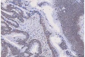 IHC analysis of HnRNP H/HNRNPH1 using anti-HnRNP H/HNRNPH1 antibody (ABIN4886623). (HNRNPH1 anticorps  (N-Term))