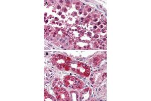 Immunohistochemical (Formalin/PFA-fixed paraffin-embedded sections) staining in human testis (A) and human kidney (B) with NPSR1 polyclonal antibody . (NPSR1 anticorps  (2nd Extracellular Domain))