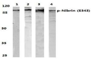 Image no. 1 for anti-Nibrin (NBN) (pSer343) antibody (ABIN318326) (Nibrin anticorps  (pSer343))