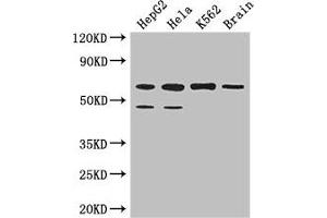 Western Blot Positive WB detected in: HepG2 whole cell lysate, Hela whole cell lysate, K562 whole cell lysate, Mouse brain tissue All lanes: PAF1 antibody at 3. (PAF1/PD2 anticorps  (AA 1-300))