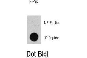 Image no. 1 for anti-Tumor Protein P53 (TP53) (pThr55) antibody (ABIN358423) (p53 anticorps  (pThr55))