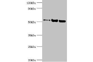 Western blot All lanes: Carbonic anhydrase 1 antibody at 2 μg/mL Lane 1: HepG2 whole cell lysate Lane 2: 293T whole cell lysate Lane 3: 293T whole cell lysate Secondary Goat polyclonal to rabbit IgG at 1/10000 dilution Predicted band size: 53, 14 kDa Observed band size: 53 kDa