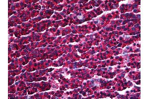 Anti-PRKRA / PACT antibody IHC of human tonsil.