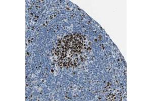 Immunohistochemical staining (Formalin-fixed paraffin-embedded sections) of human lymph node with MCM4 polyclonal antibody  shows strong nuclear positivity in cells in reaction center. (MCM4 anticorps)