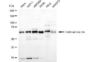Western blotting analysis using forkhead box O4 antibody (ABIN7798649).