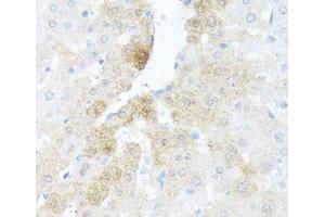 Immunohistochemistry of paraffin-embedded Rat liver using BCL2L2 Polyclonal Antibody at dilution of 1:100 (40x lens).
